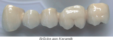 Bruecke aus Keramik